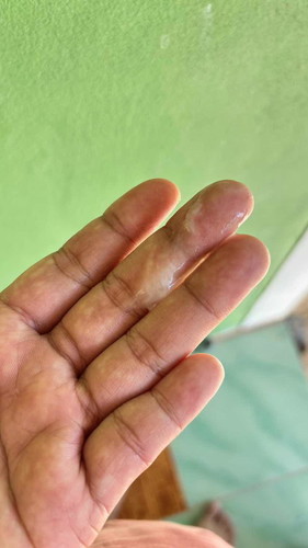 สอบถามมูกขาวๆคืออะไรค่ะ