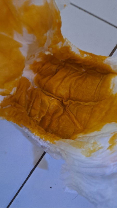 Mohon maaf ini foto poop bayi ku
Berbagi pengalaman dong moms karena aku masih newmon