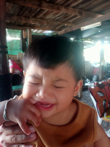 เเม่ๆเเนะนำตัวช่วยให้ผมน้องยาวไวหน่อยค่ะ ยายๆที่บ้านเเอบตัดผมข้างหน้าลูก