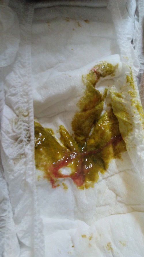 Diare bayi usia 6 bulan