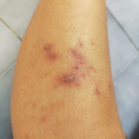 แม่ๆคนไหนเป็นบ้างค่ะ