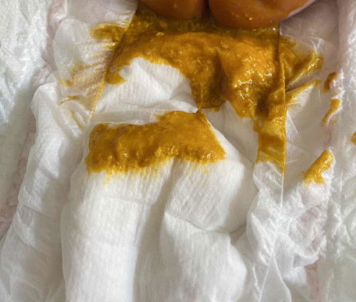 ลัษณะอึของลูก