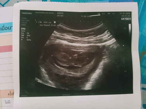 เขาเรียกหัวปีท้ายปีไหมค่ะ