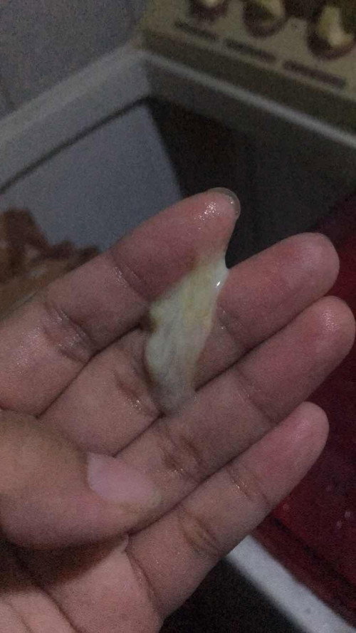 Usia kandungan 37 minggu 2 hari