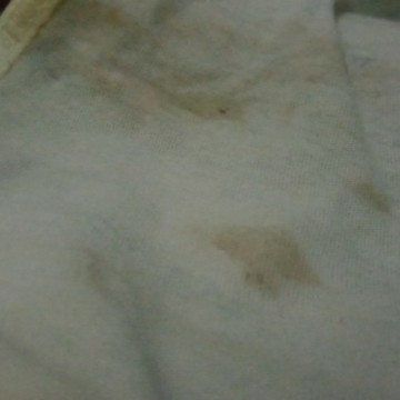 Bun ini apa ya?
Aku hpl 10 NOV,krna mau pipis dan bab v ku terasa sakit JD aku pakai dalaman