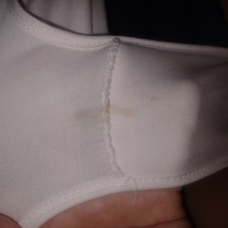 Normal spotting lang mga ba to mga mie?