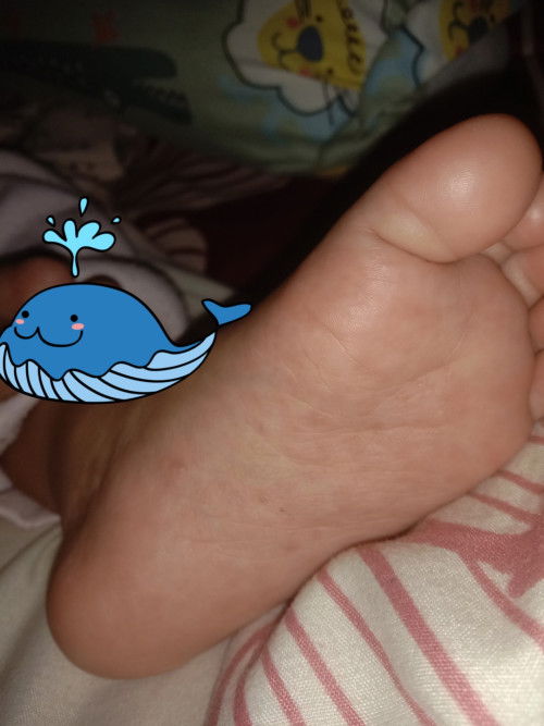 Anak 1 tahun 5 bulan