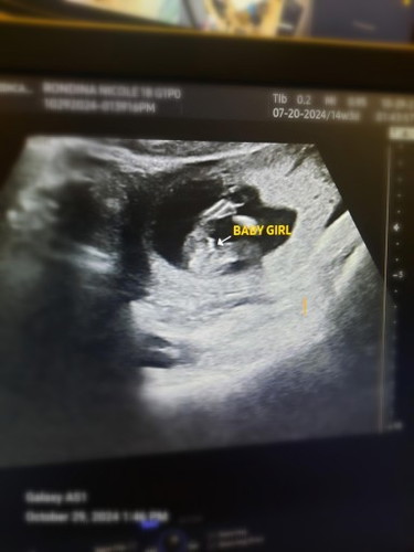 3months preggy