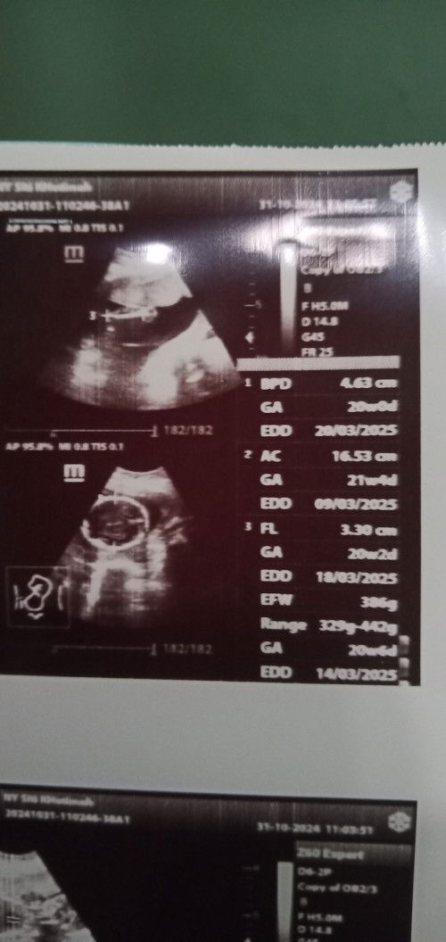 Hasil usg dari rumah sakit