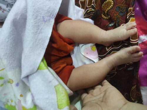 Kaki bayi seperti ini apakah normal?