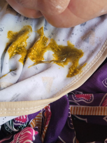 Bayi umur 1 bulan 11 hari