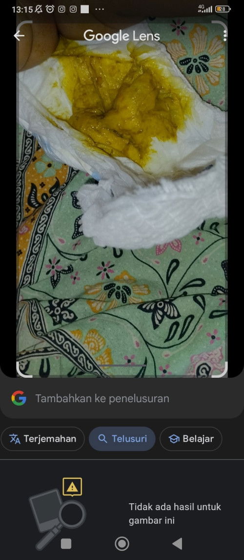 Pup bayi normal apa tidak