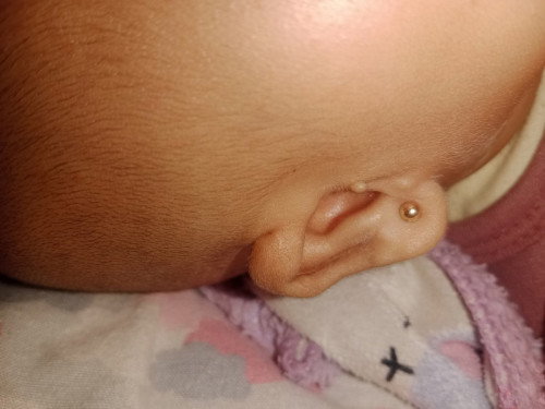 Daun telinga bayi