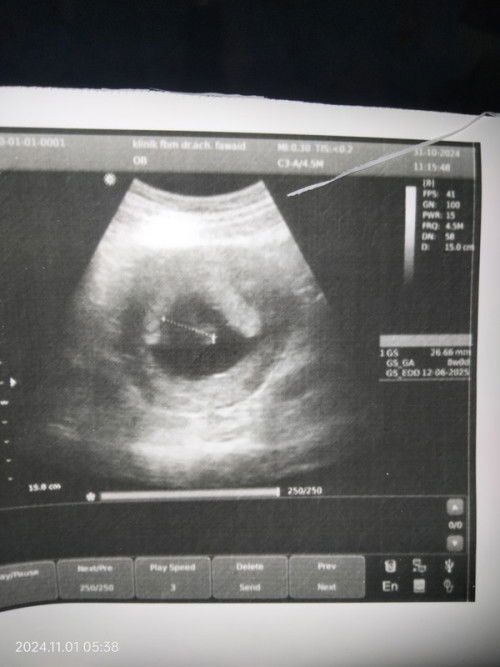 uk di apk 11mg tapi pas usg 8mg