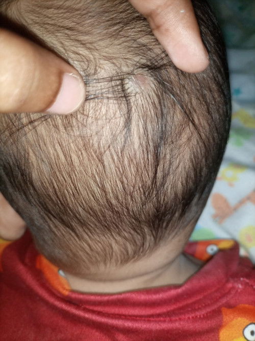 Ask kolang po kung ano po itong nasa ulo ng baby ko 2 months po simula po nung napansin po namin yan