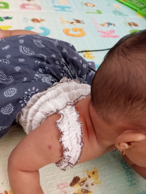 Info dong bun ini ciri tortikolis bukan ya