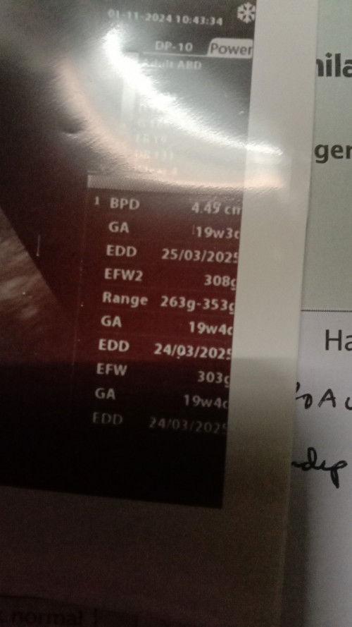 Usia kehamilan 17 Minggu