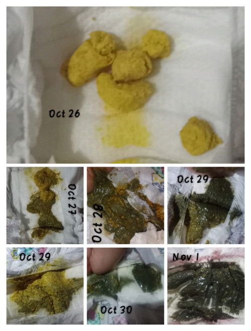 Dark green na dumi ng baby