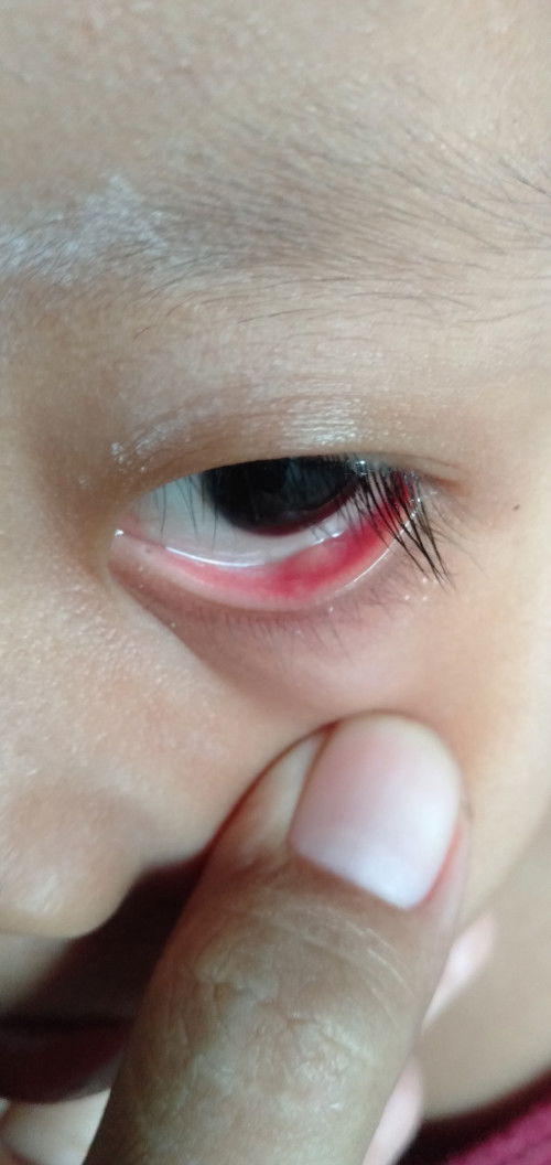 Haii bunda² barang kali disini ada anaknya yng pernah ngalamin kaya gini .