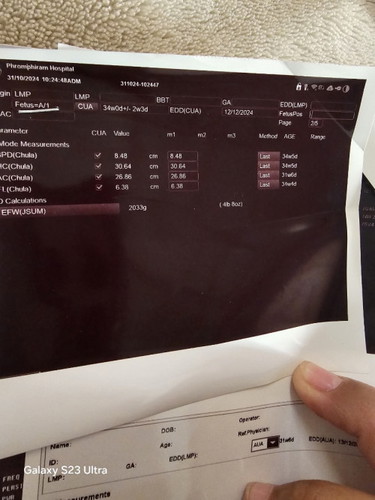 น้ำหนักลูกน้อย