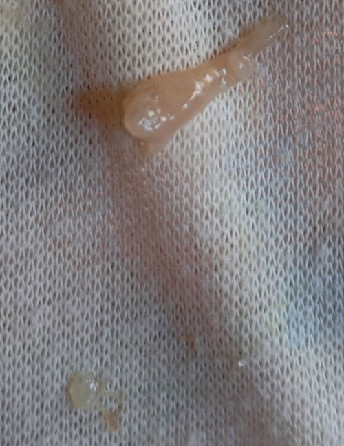 Keluar keputihan kecoklatan HPL 11 November