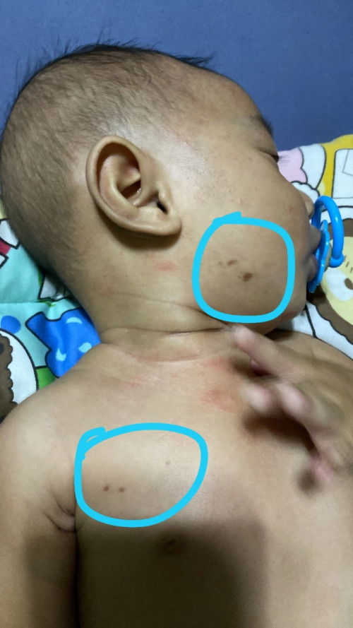 Ano po kaya yung nasa baby ko color brown po sya na tumubo?