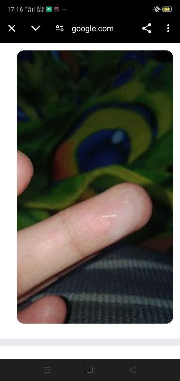 Sharing dong bunda² ada yang sama gk?