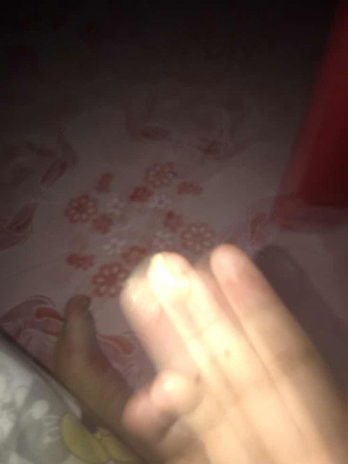 มีมูกแบบนี่ออกมาคืออะไรหรอค่ะ ช่วยดูหน่อยค่ะ พอดีกล้องมันสั่นถ่ายไม่ได้เลย เลยเอารูปที่อื่นมาคล้ายแบบนี้เลยค่ะ 38+1 🙏