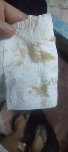 brown discharge