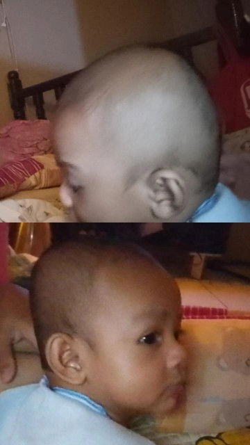 Mengatasi kepala bayi