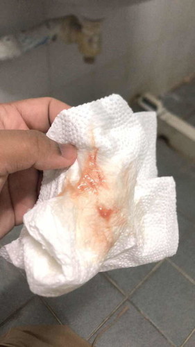 ตรวจปากมดลูก