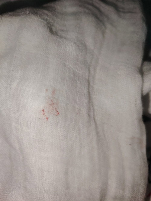 2weeks and 6days old c baby