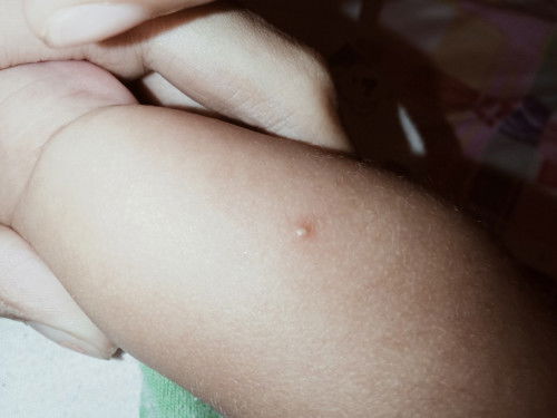 ANO KAYANG INSECTS GUMAWA NETO?