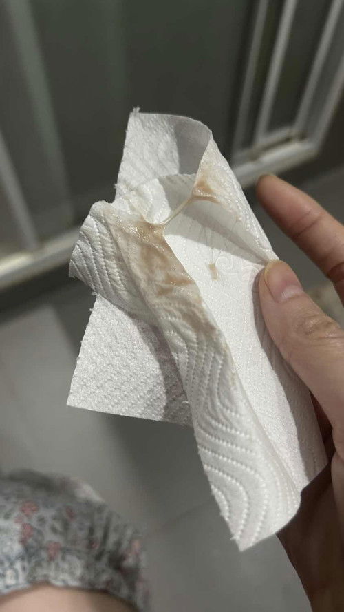 ตั้งครรภ์ 9w6d มีมูกออกมาแบบนี้ อันตรายไหมคะ พอดีอีก 4 วันจะต้องไปตรวจอยู่แล้วค่ะ รอไปที่หมอนัดเลยได้ไหมคะ หรือต้องรีบไปเลย