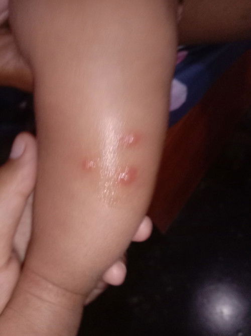 Bayi umur 3 bulan 12 hari