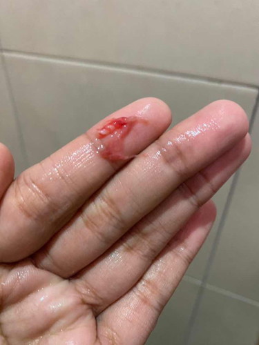 normal ke kalau mcm ni? ade bleeding sikit.. sekarang kdungan 6 weeks. sy prnah 2 kali gugur.