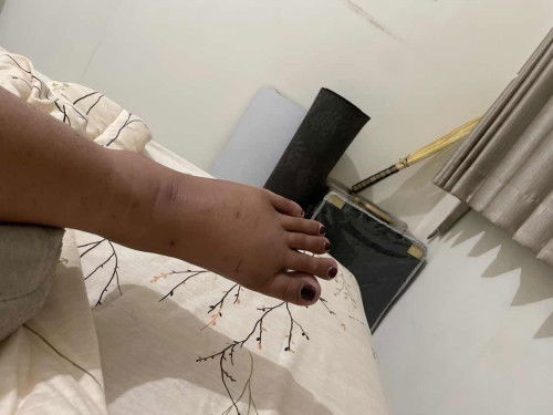 Ada yg pernah digigit kucing pas hamil?