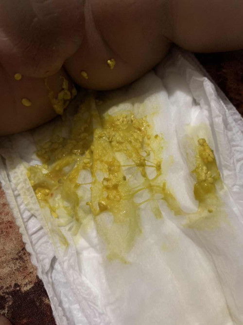 BAB 1 hari lebih dari 1 kali apakah normal?