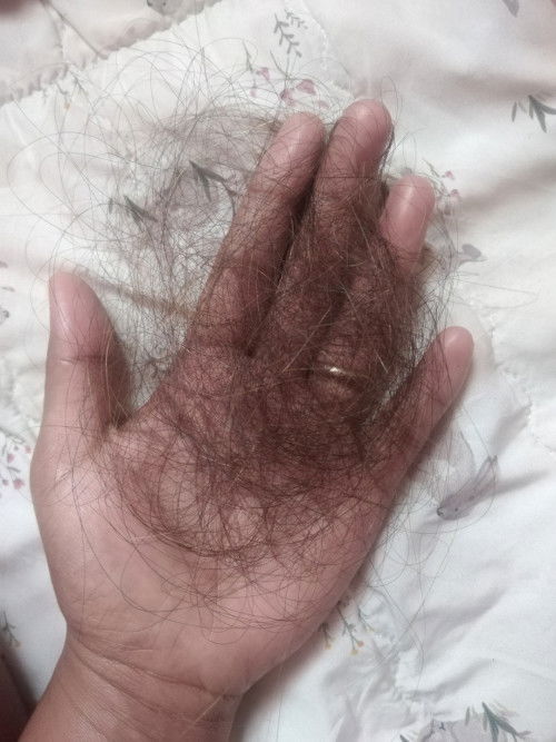 Mga mee normal Lang ba?