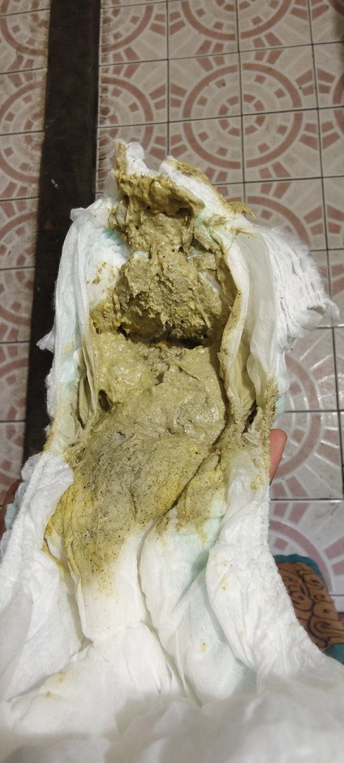 TANYA POOP BAYI (MAAF JIKA FOTONYA MENJIJIKKAN :( )