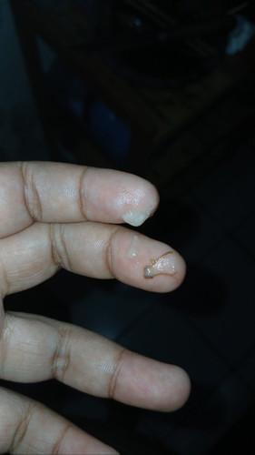 Keputihan wajar ga ya blm periksa soalnya nunggu gajihan bantu jawab ya bunda
