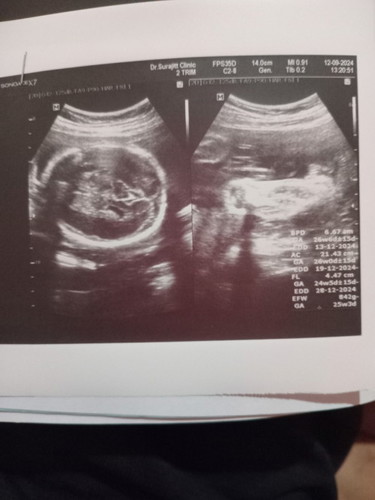 แม่ๆช่วยดูให้หน่อยค่ะ