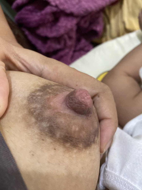 Nipple thrush o wrong flange size?