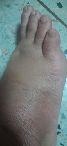 สอบถามแม่ๆค่ะ ท้องแรก