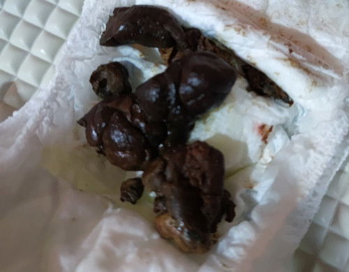 Anak saya udh 2 mingguan eeh kyak gini, eehnya tiap hari tapi klo eeh susah bgt kluarinnya