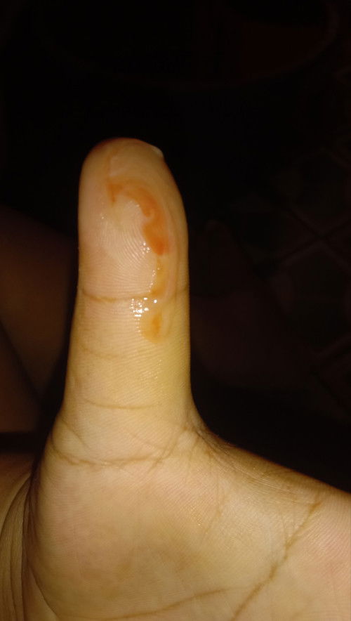 Wajar gak sih bund di kehamilan 5bln keluar flek