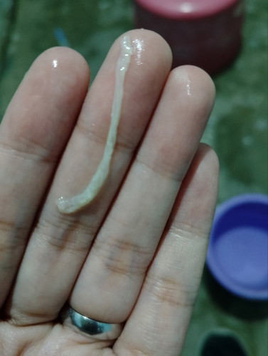 Vaginal discharge