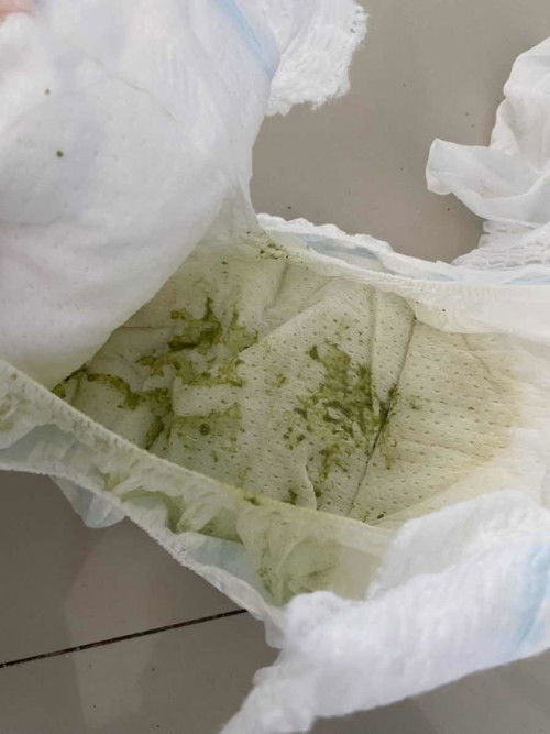 ลูกไม่สบาย มีอาการแหวะนม อึเขียว