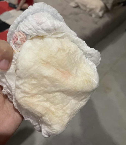 pampers bayi ada bercak merah, bayi 7 bulan, laki laki