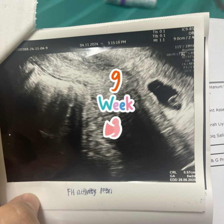 9 weeks 2 day